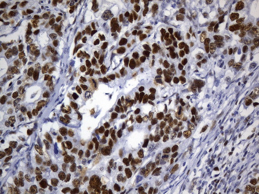 MSH6 Antibody in Immunohistochemistry (Paraffin) (IHC (P))