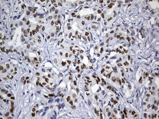 MSH6 Antibody in Immunohistochemistry (Paraffin) (IHC (P))