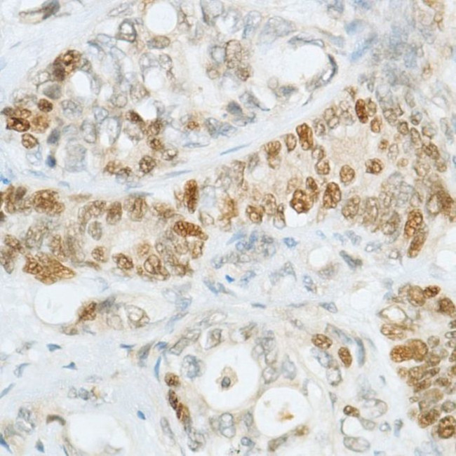 MSH6 Antibody in Immunohistochemistry (Paraffin) (IHC (P))