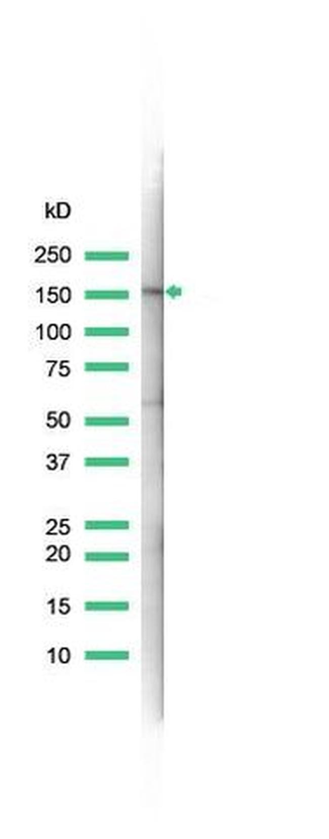 MSH6 Antibody in Western Blot (WB)