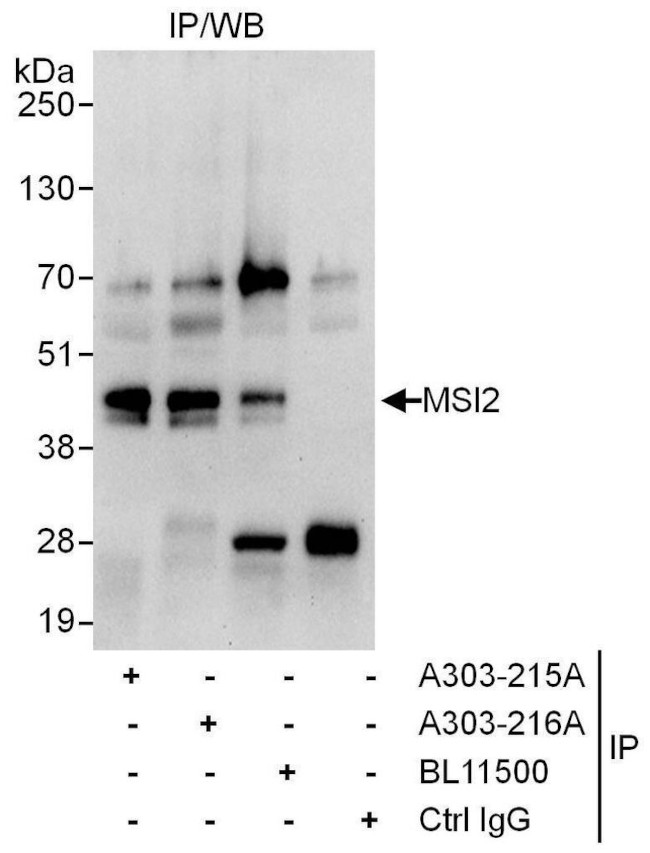 MSI2 Antibody in Immunoprecipitation (IP)