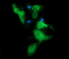 MSI2 Antibody in Immunocytochemistry (ICC/IF)