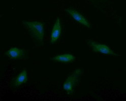 MSI2 Antibody in Immunocytochemistry (ICC/IF)