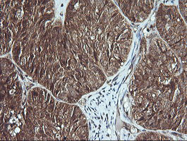 MSI2 Antibody in Immunohistochemistry (Paraffin) (IHC (P))