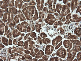 MSI2 Antibody in Immunohistochemistry (Paraffin) (IHC (P))