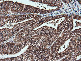 MSI2 Antibody in Immunohistochemistry (Paraffin) (IHC (P))