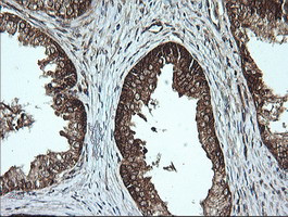 MSI2 Antibody in Immunohistochemistry (Paraffin) (IHC (P))