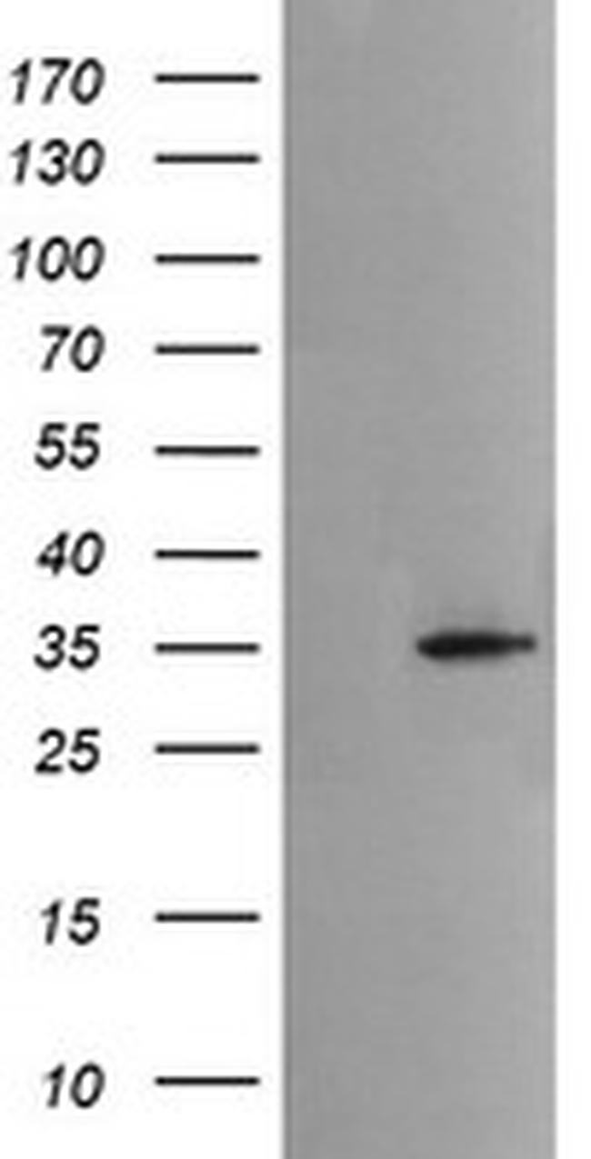 MSI2 Antibody in Western Blot (WB)