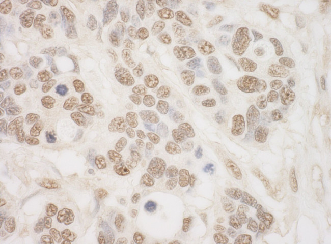 MSK2 Antibody in Immunohistochemistry (IHC)