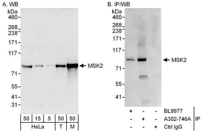 MSK2 Antibody in Western Blot (WB)