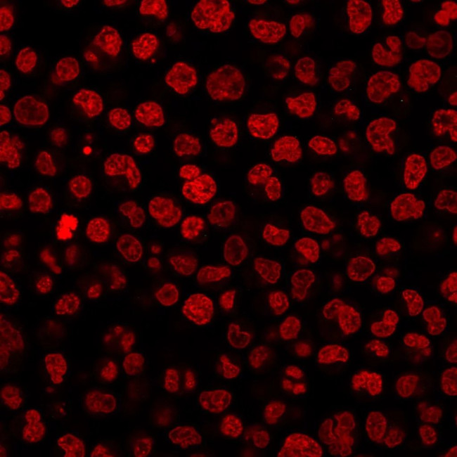 IgG1 Isotype Control for Mouse Antibody in Immunocytochemistry (ICC/IF)