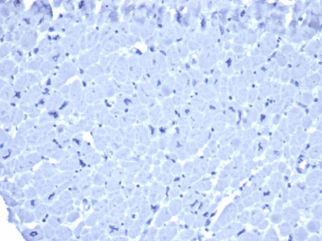 IgG1 Isotype Control for Mouse Antibody in Immunohistochemistry (Paraffin) (IHC (P))