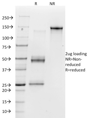 Vitronectin Receptor/CD51/CD61 Antibody in SDS-PAGE (SDS-PAGE)