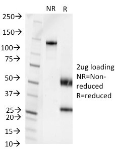 Pseudomonas aeruginosa serotype 6C Antibody in SDS-PAGE (SDS-PAGE)