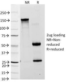 Lewis A (Blood Group Antigen) Antibody in SDS-PAGE (SDS-PAGE)