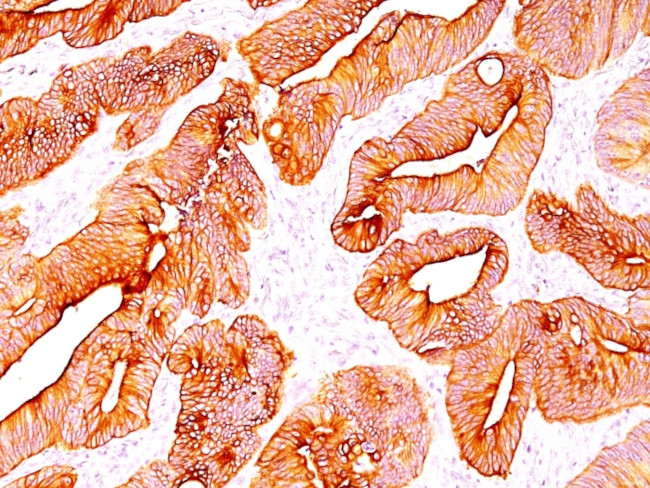 Cytokeratin, Multi (Epithelial Marker) Antibody in Immunohistochemistry (Paraffin) (IHC (P))