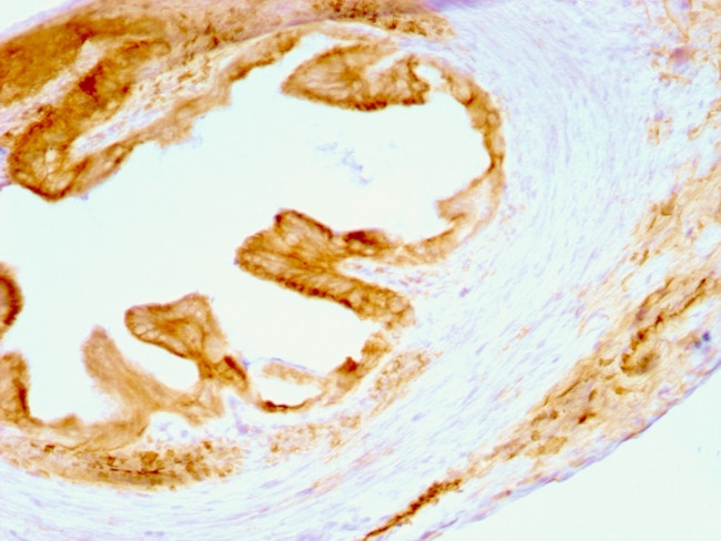 Cytokeratin, Multi (Epithelial Marker) Antibody in Immunohistochemistry (Paraffin) (IHC (P))