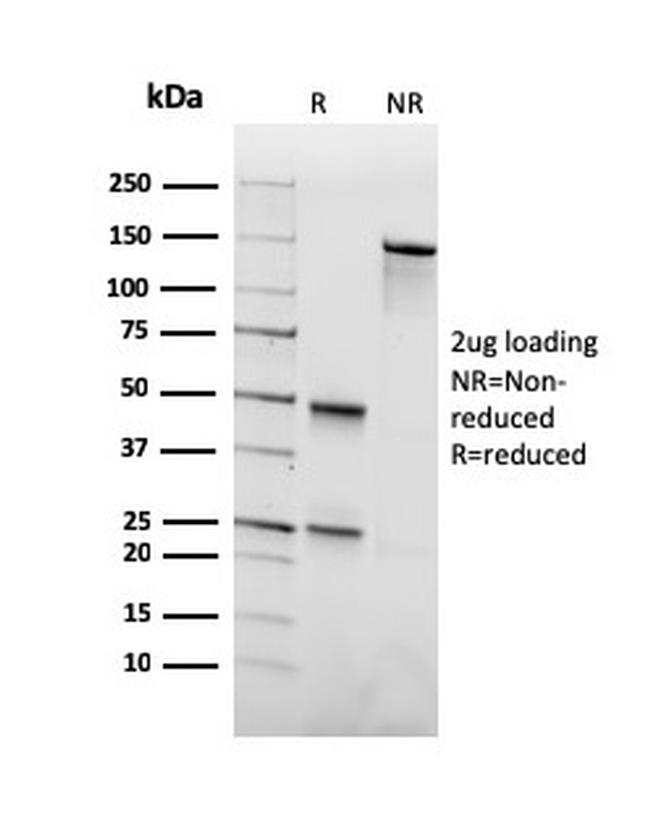 Biotin (Vitamin B7 or Vitamin H) Antibody in SDS-PAGE (SDS-PAGE)