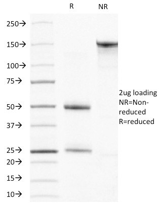 Actin, Muscle Specific (Muscle Cell Marker) Antibody in SDS-PAGE (SDS-PAGE)