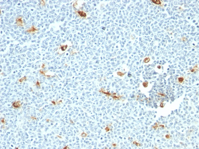Macrophage, pan (Histiocytoma and Sebocyte Marker) Antibody in Immunohistochemistry (Paraffin) (IHC (P))