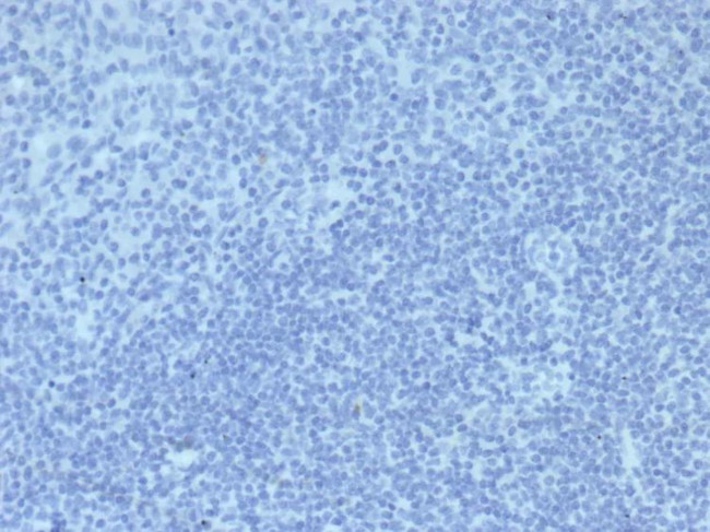 IgG2a Isotype Control for Mouse Antibody in Immunohistochemistry (Paraffin) (IHC (P))