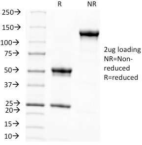 KBA.62 (Melanoma Associated Antigen) Antibody in SDS-PAGE (SDS-PAGE)