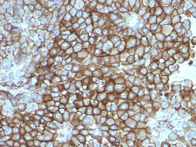 KBA.62 (Melanoma Associated Antigen) Antibody in Immunohistochemistry (Paraffin) (IHC (P))
