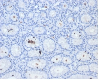 Helicobacter pylori (Catalase) Antibody in Immunohistochemistry (Paraffin) (IHC (P))