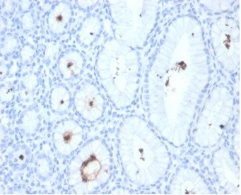 Helicobacter pylori (Catalase) Antibody in Immunohistochemistry (Paraffin) (IHC (P))