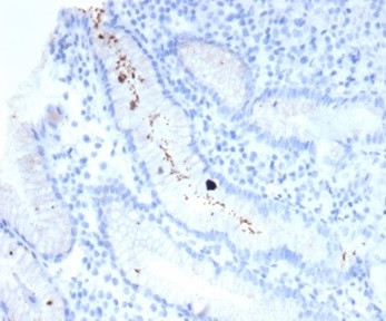 Helicobacter pylori (Catalase) Antibody in Immunohistochemistry (Paraffin) (IHC (P))