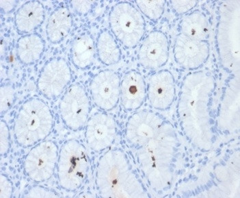 Helicobacter pylori (Catalase) Antibody in Immunohistochemistry (Paraffin) (IHC (P))