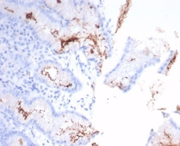 Helicobacter pylori (Catalase) Antibody in Immunohistochemistry (Paraffin) (IHC (P))