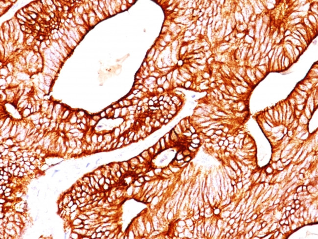 Cytokeratin 8/18 Antibody in Immunohistochemistry (Paraffin) (IHC (P))