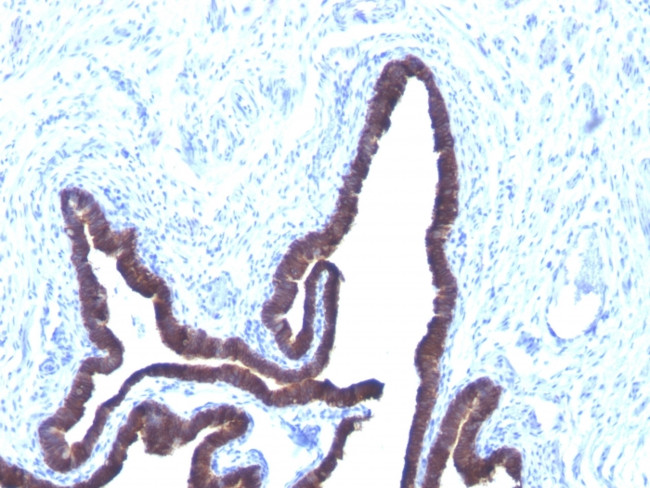 Cytokeratin 8/18 Antibody in Immunohistochemistry (Paraffin) (IHC (P))