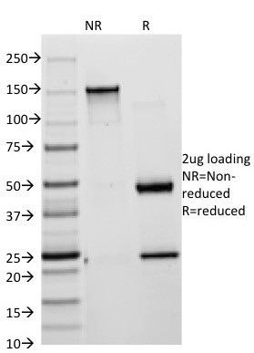 Cytokeratin 8/18 Antibody in SDS-PAGE (SDS-PAGE)