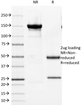 Cytokeratin 8/18 Antibody in SDS-PAGE (SDS-PAGE)