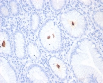 Helicobacter pylori (Catalase) Antibody in Immunohistochemistry (Paraffin) (IHC (P))