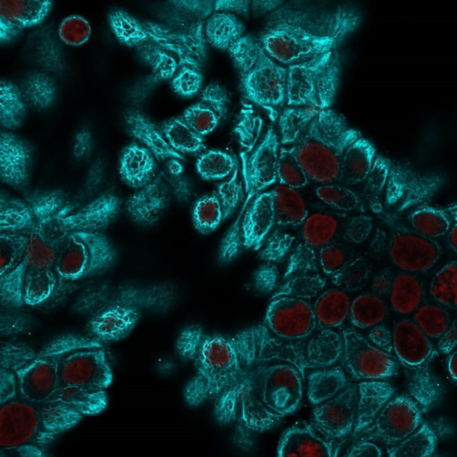 Cytokeratin, pan Antibody in Immunocytochemistry (ICC/IF)