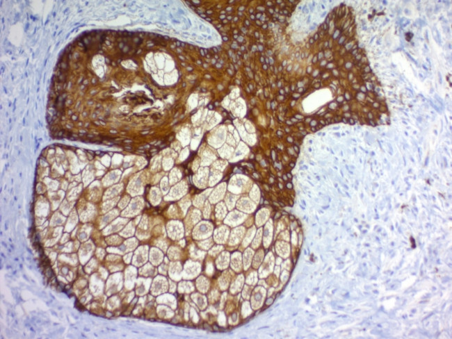 Cytokeratin, pan Antibody in Immunohistochemistry (Paraffin) (IHC (P))