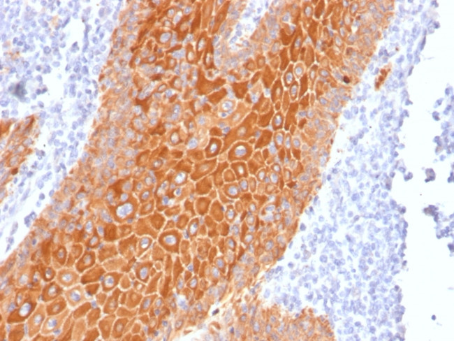 Cytokeratin, pan Antibody in Immunohistochemistry (Paraffin) (IHC (P))