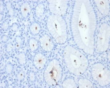 Helicobacter pylori (Catalase) Antibody in Immunohistochemistry (Paraffin) (IHC (P))