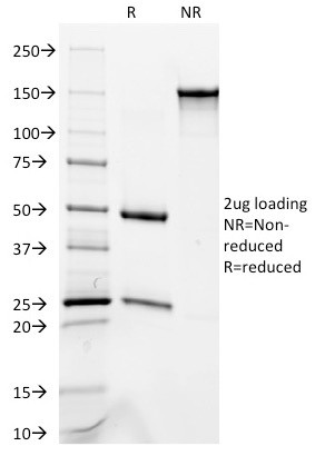 Cytokeratin 8/18 Antibody in SDS-PAGE (SDS-PAGE)