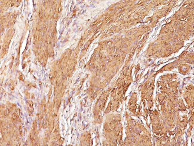 Actin, Muscle Specific (Muscle Cell Marker) Antibody in Immunohistochemistry (Paraffin) (IHC (P))