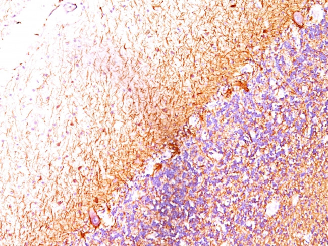 Neurofilament (H+L) (Neuronal Marker) Antibody in Immunohistochemistry (Paraffin) (IHC (P))