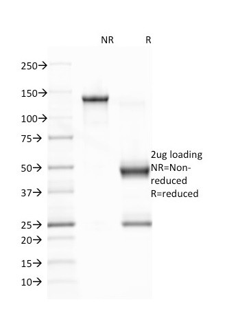 Epstein-Barr Virus (LMP-1) Antibody in SDS-PAGE (SDS-PAGE)