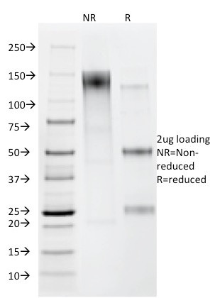Helicobacter pylori Antibody in SDS-PAGE (SDS-PAGE)