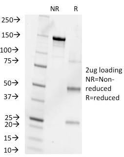 Progesterone Antibody in SDS-PAGE (SDS-PAGE)