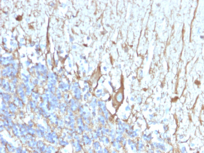 Neurofilament (H+L) (Neuronal Marker) Antibody in Immunohistochemistry (Paraffin) (IHC (P))