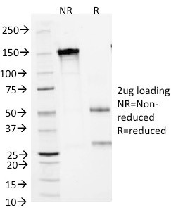 Small Cell Lung Carcinoma Antigen (SCLC Marker) Antibody in SDS-PAGE (SDS-PAGE)