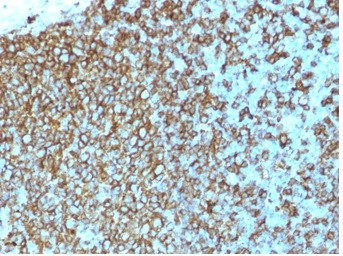 HLA-Pan (MHC II) Antibody in Immunohistochemistry (Paraffin) (IHC (P))